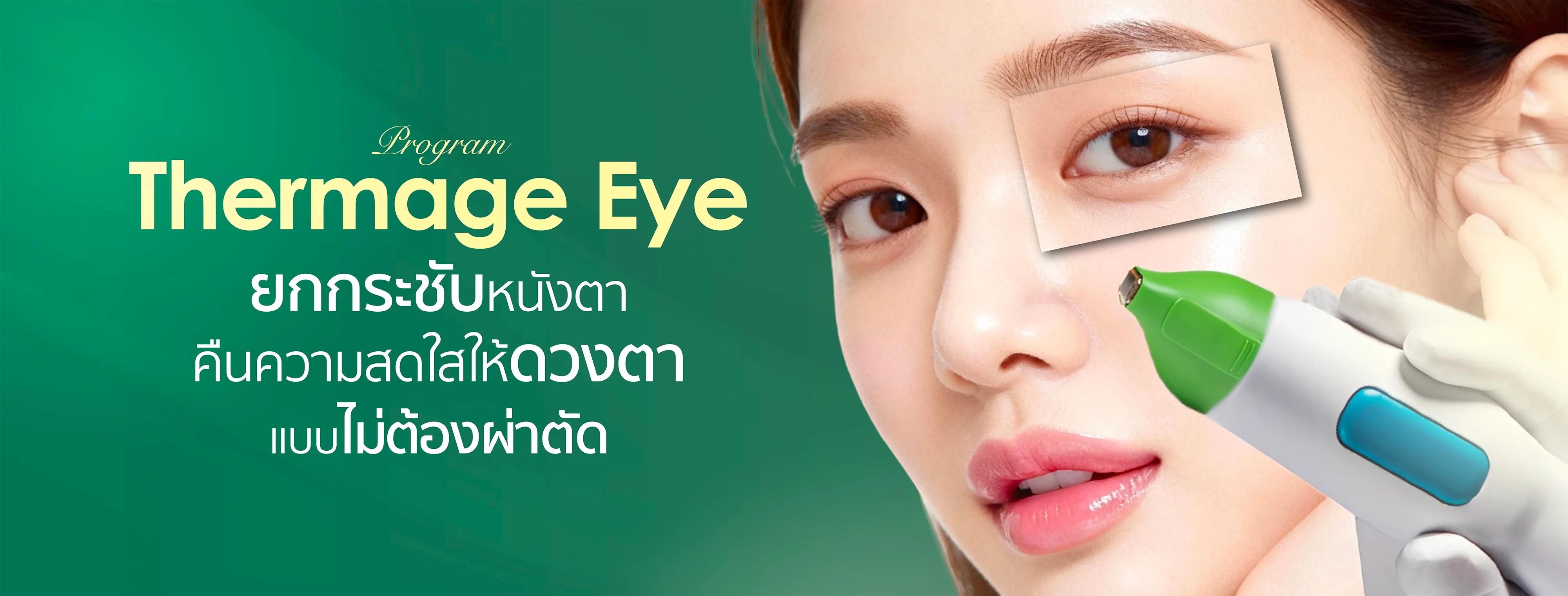 Thermage Eye