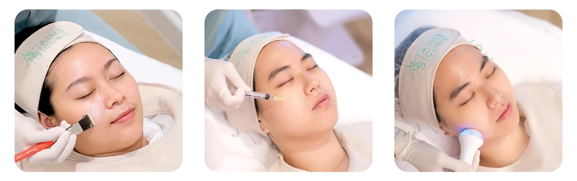 Treatment-11.webp