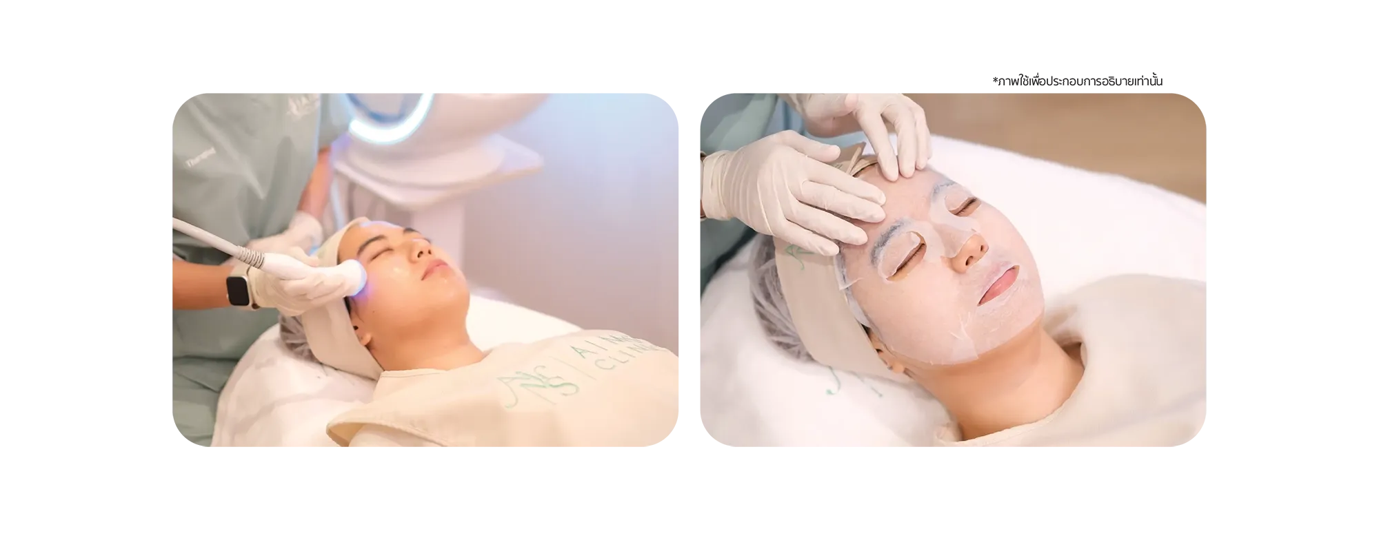 Treatment_Laser-02.webp
