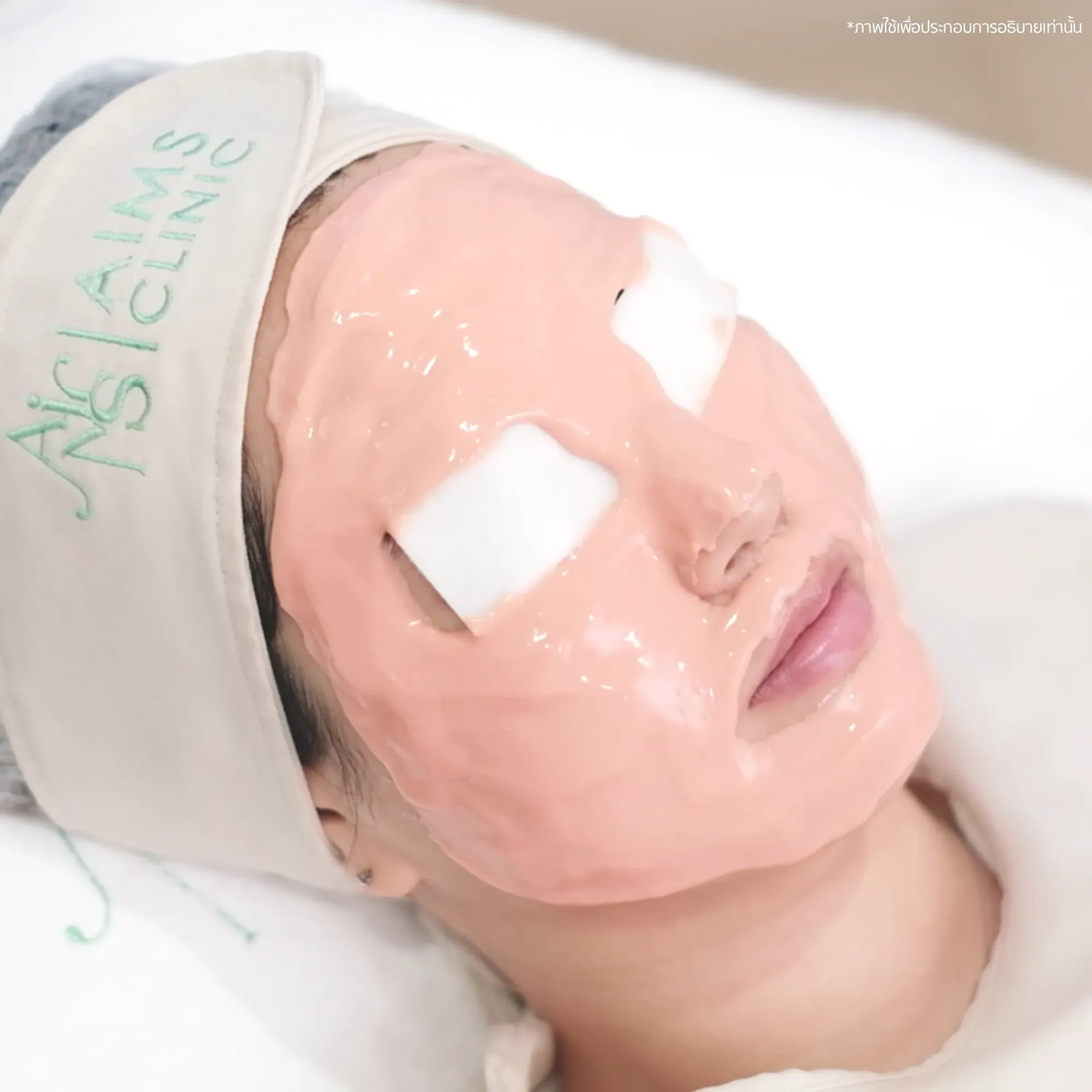 Treatment_Laser-03.webp
