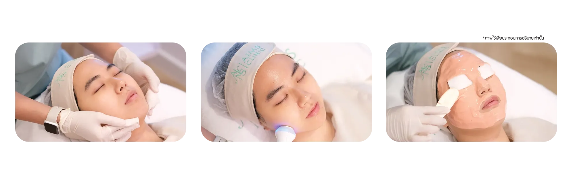 Treatment_Laser-09.webp