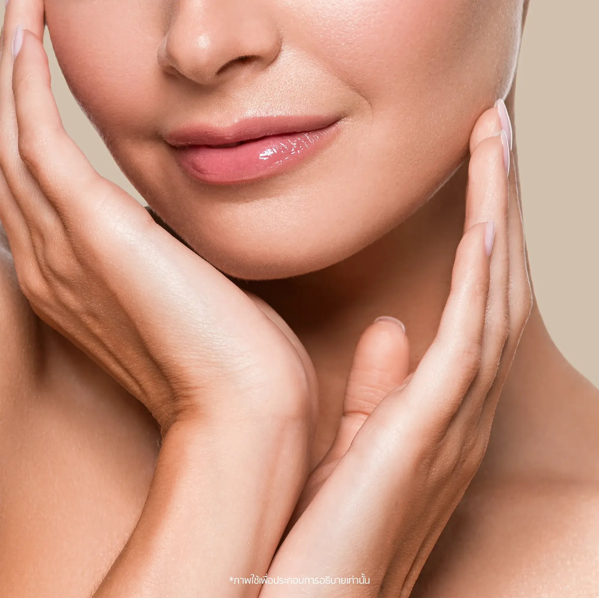 acne-05.webp