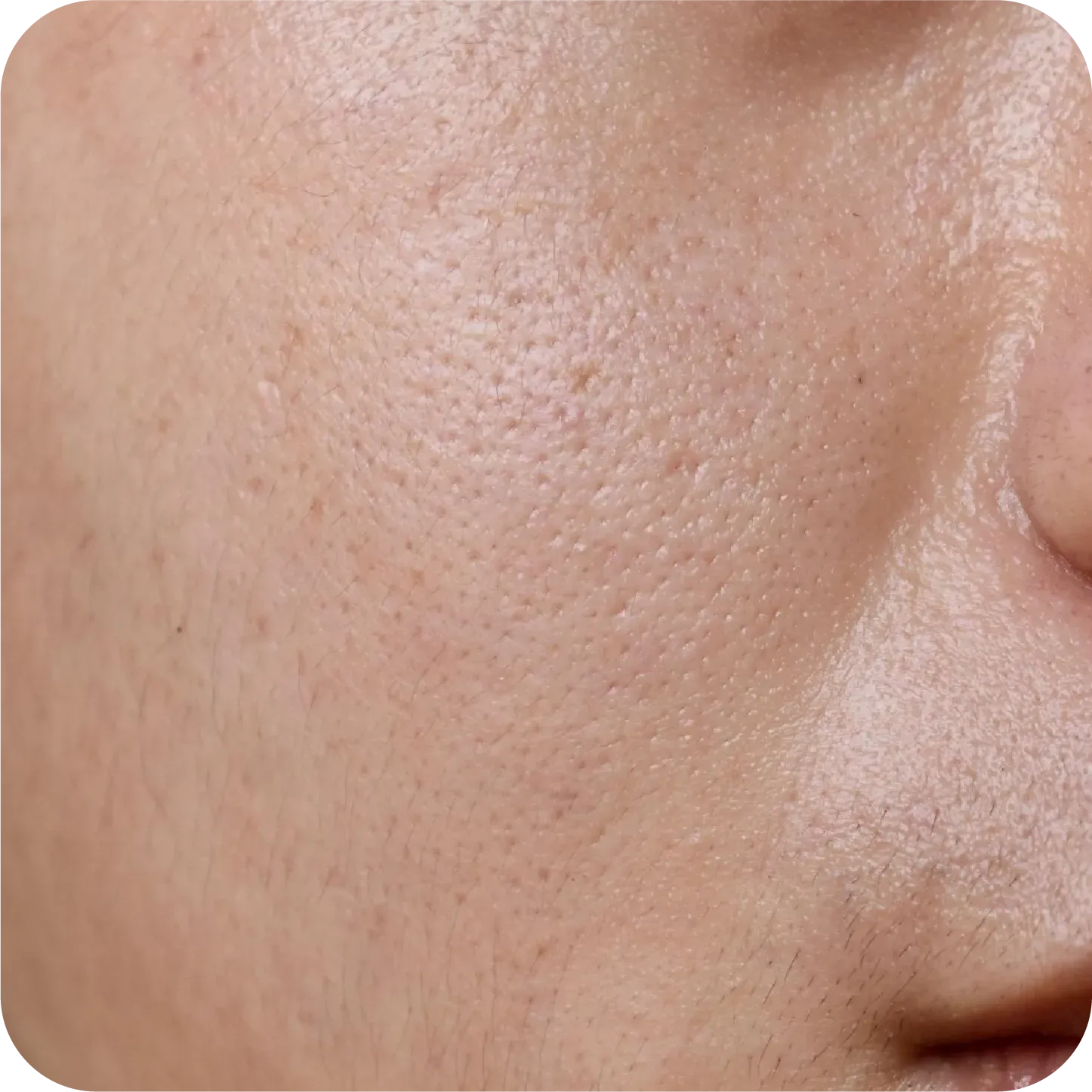 Asset 123000.webp