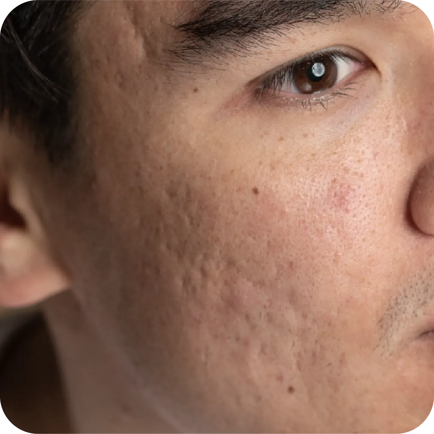 Asset 73000.webp